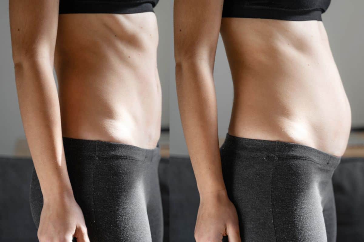 How long does diastasis recti take to improve Greater London (Kensington and Chelsea)?