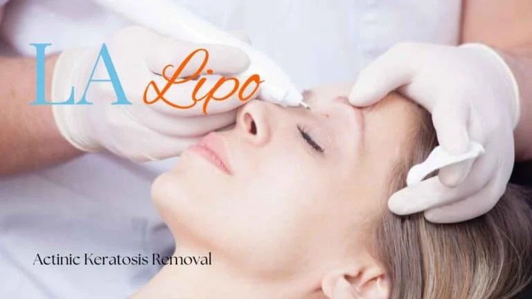 Woman receiving Actinic Keratosis Removal Treatment Greater London (Kensington and Chelsea)