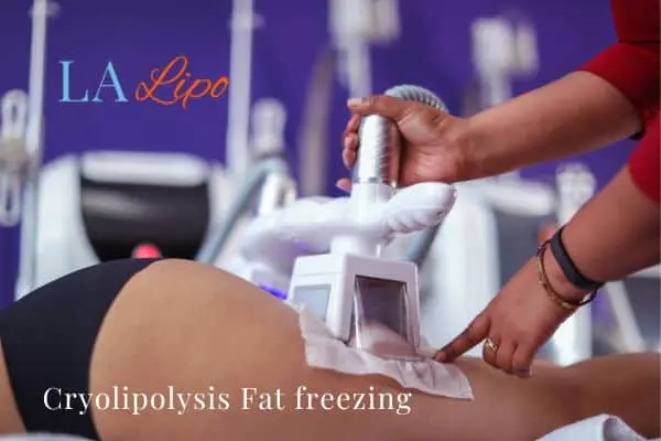 women getting fat freezing Greater London (Kensington and Chelsea)