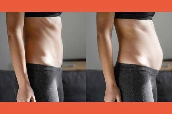 LA-EMS Body Sculpting results Greater London (Kensington and Chelsea)