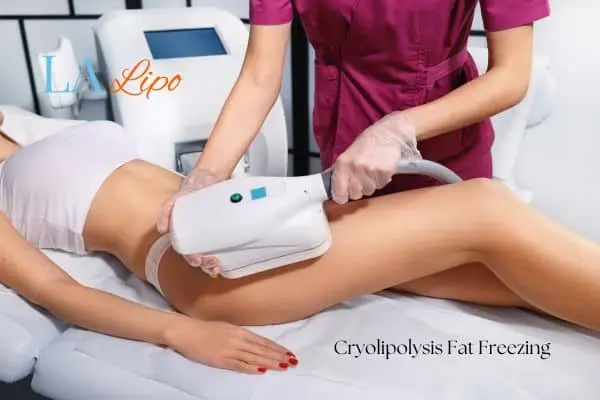 Woman receiving coolsculpting Greater London (Kensington and Chelsea) treatment on her thighs