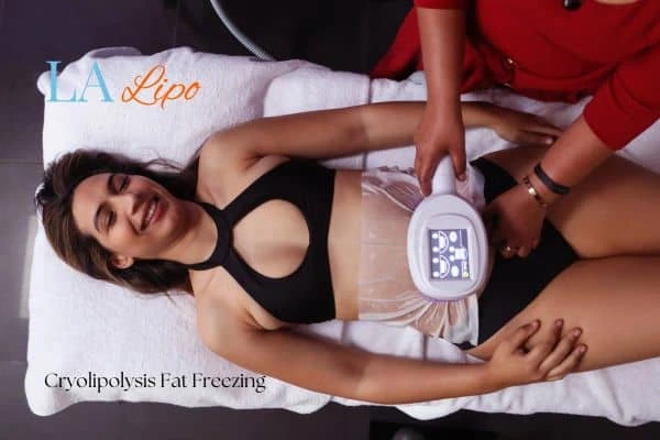 woman getting cryolipolysis Greater London (Kensington and Chelsea)