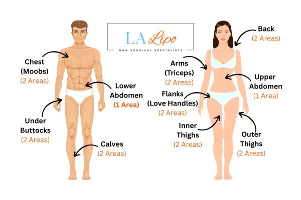 LA LIPO Cryolipolysis Areas Greater London (Kensington and Chelsea)