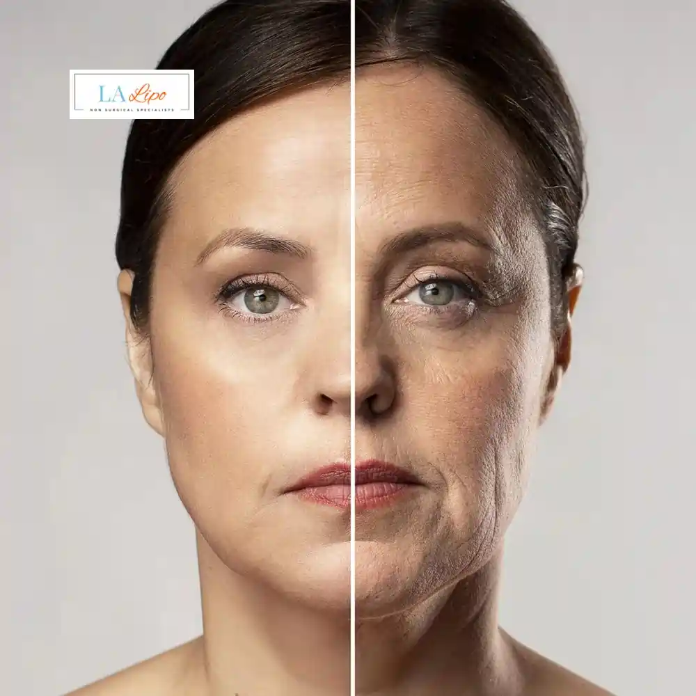 How Can You Tell If Non-Surgical Skin Tightening Is Right for You Greater London (Kensington and Chelsea)?