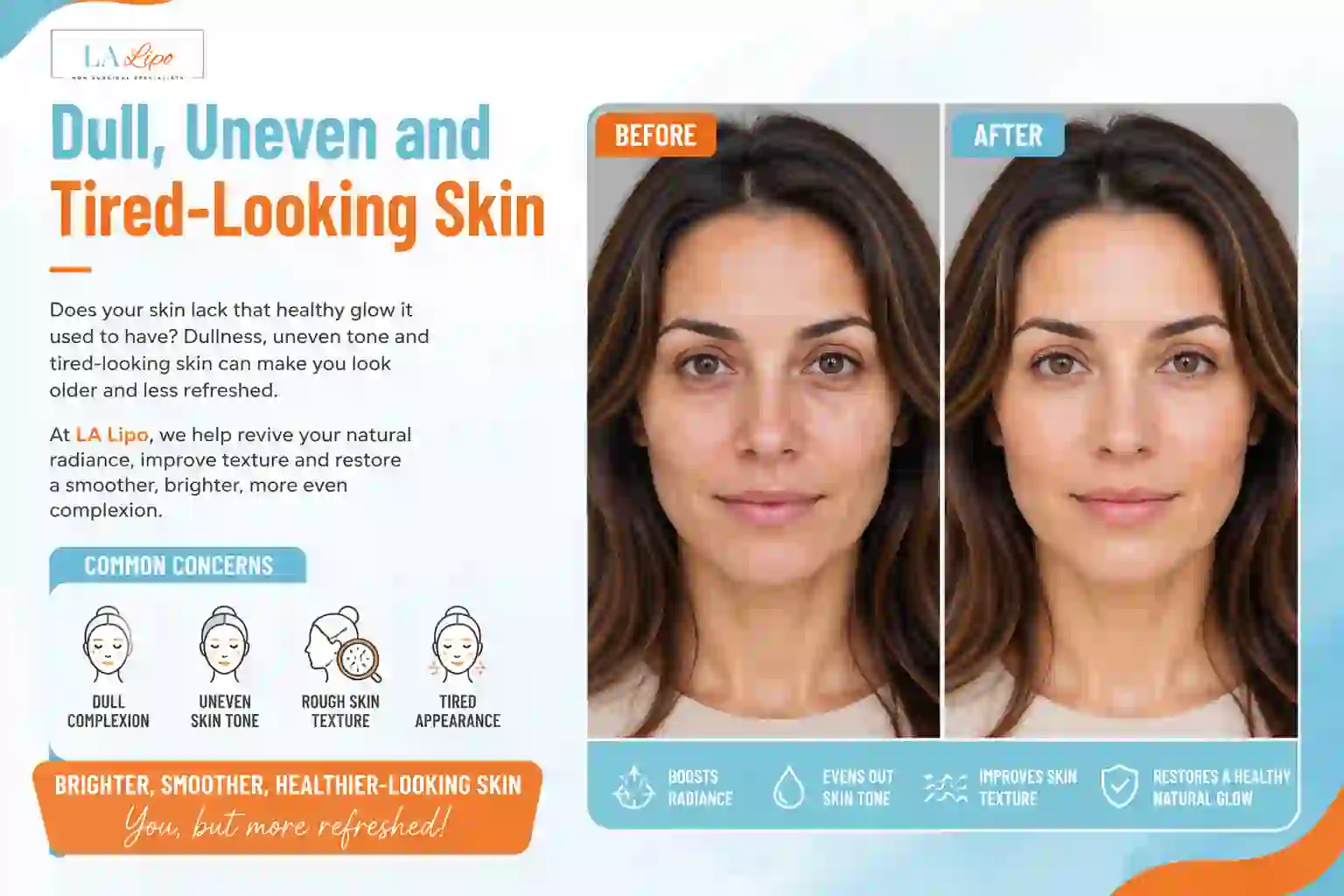 Sign #5: Dull, Uneven and Tired-Looking Skin Greater London (Kensington and Chelsea)