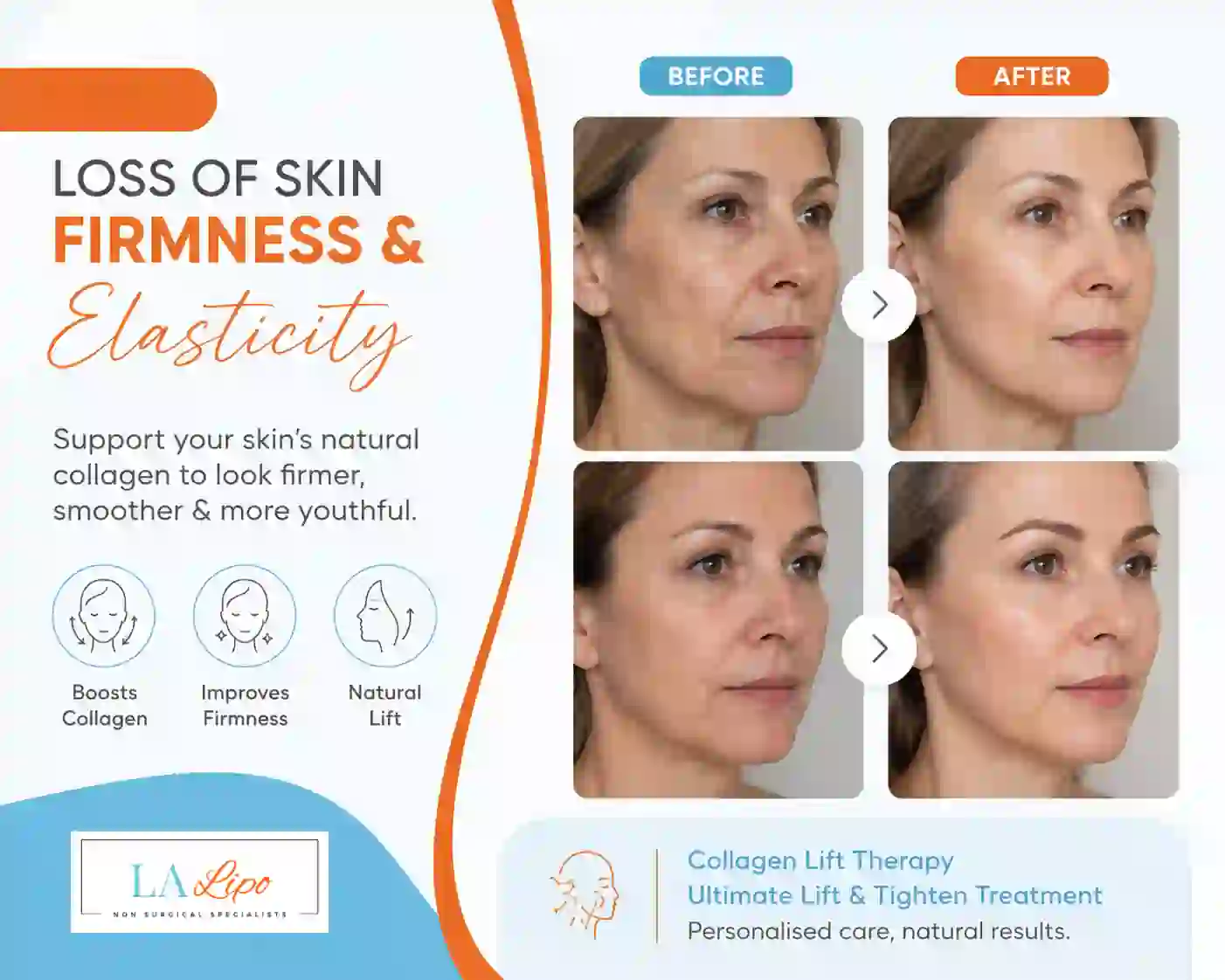 Sign #7: Loss of Skin Firmness and Elasticity Greater London (Kensington and Chelsea)